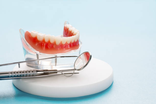 Types of Dental Prosthetics