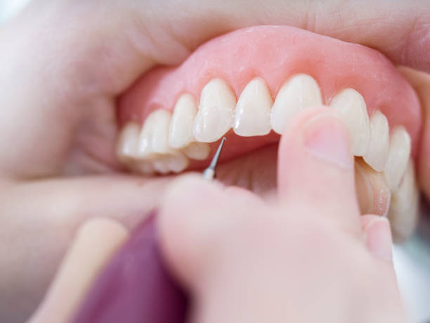 Comparing Different Types of Dental Prosthetics